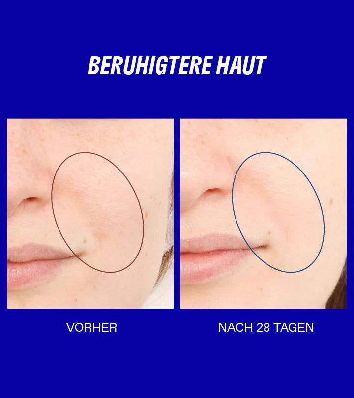 KORRES Smart Yoghurt Probiotisches Superserum